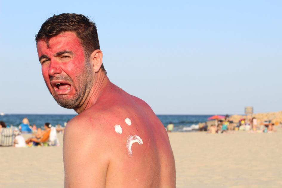 Brits urged to not try Vaseline sunburn hack this summer