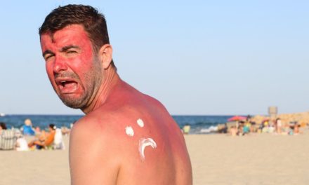 Brits urged to not try Vaseline sunburn hack this summer