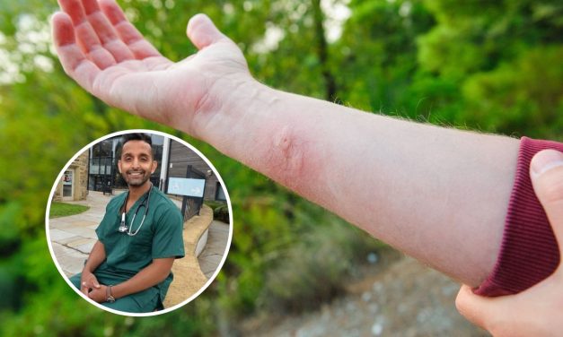 How this 1p coin hack will prevent wasp stings this summer